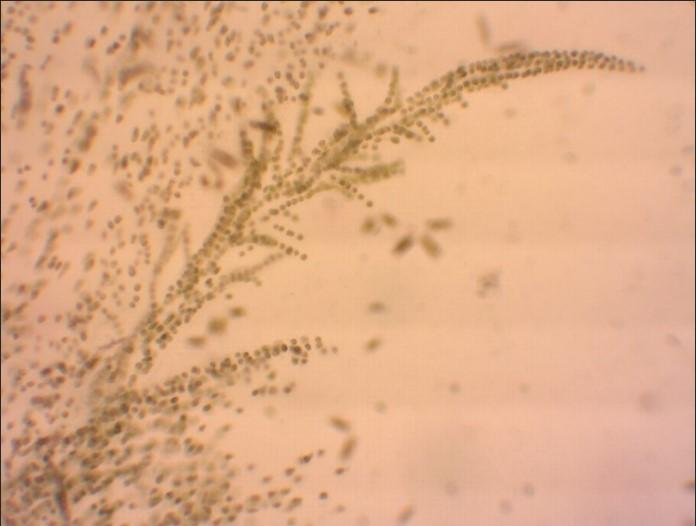 Alga dorata Hydrurus foetidus al microscopio ottico